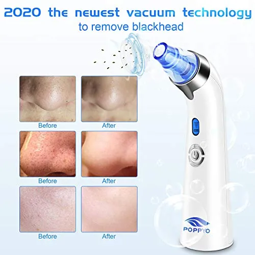 Blackhead Remover Pore Vacuum - Electric Blackhead Vacuum Cleaner Blackhead Extractor Tool Device Comedo Removal Suction Beauty Device for Women