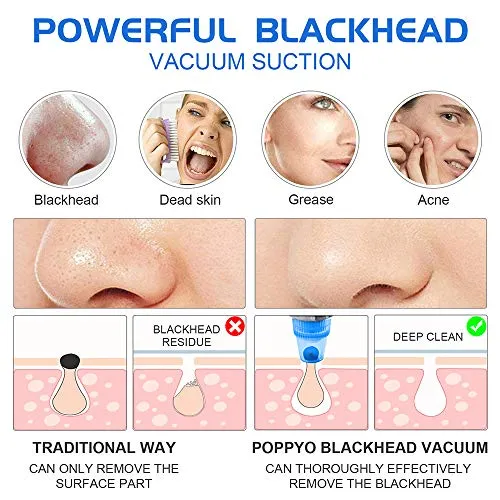 Blackhead Remover Pore Vacuum - Electric Blackhead Vacuum Cleaner Blackhead Extractor Tool Device Comedo Removal Suction Beauty Device for Women