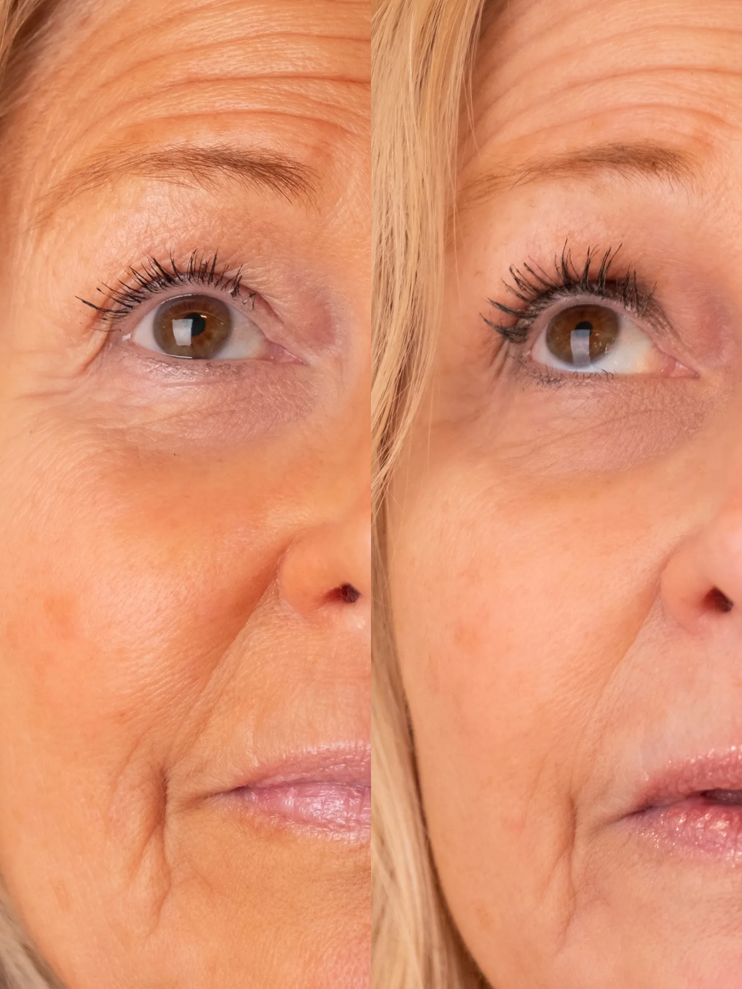 Eyelash Growth Serum