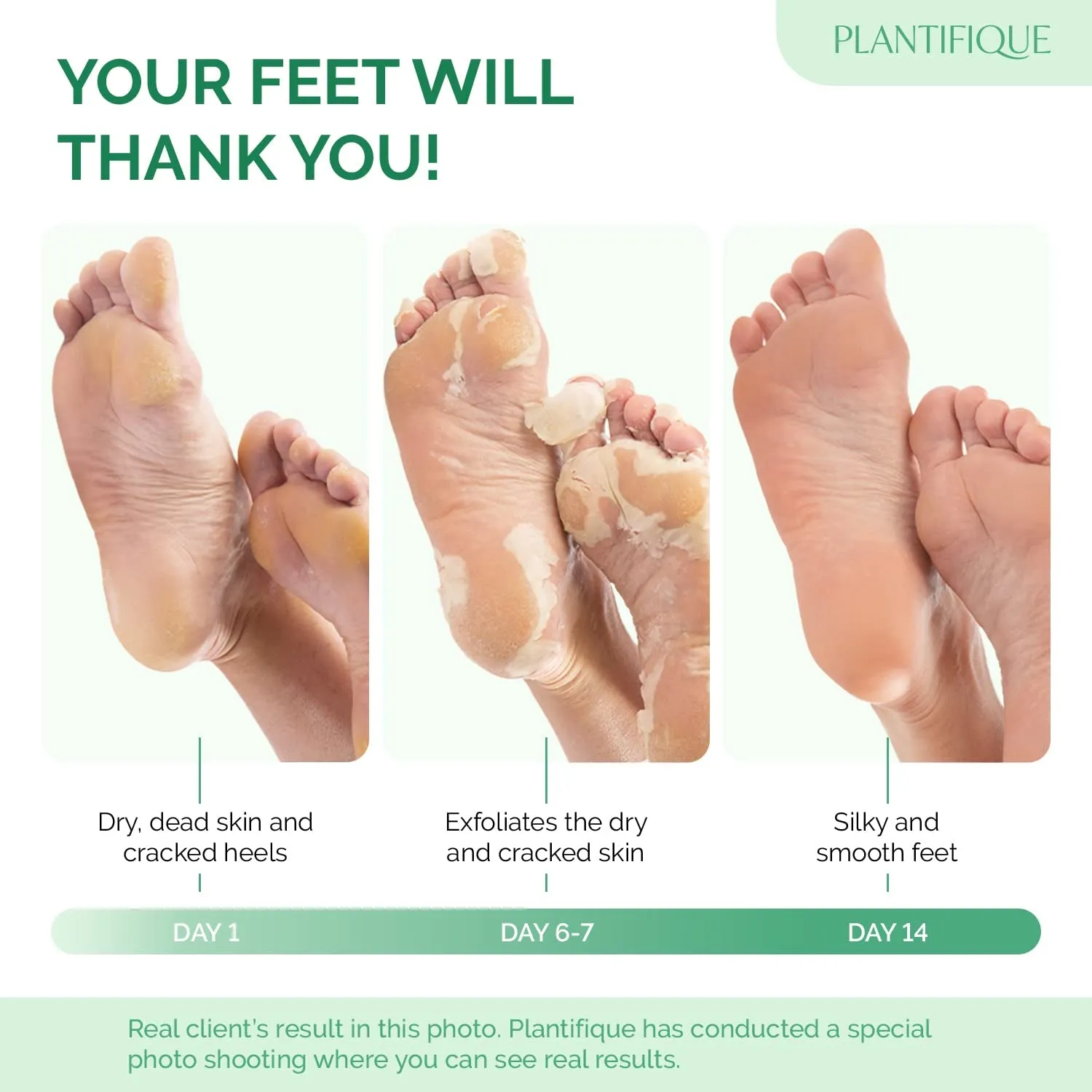 Foot Peeling Mask 2 Pack | Dermatologically Tested Repairs Heels & Removes Dry Dead Skin for Baby Soft Feet | Exfoliating Foot Peel Mask for Dry Cracked Feet | Strawberry