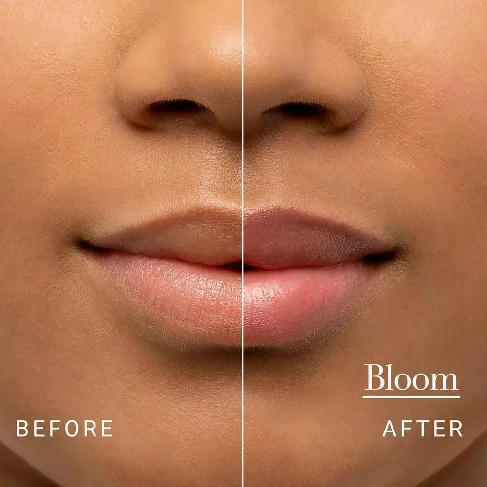 Fresh Sugar Lip Treatment