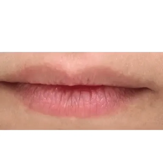 iS Clinical Lip Duo Set