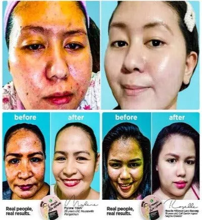 K Magic Multi-Functional Facial Skin Cream ( NOW in 2 sizes: 15 gms or 50 gms. )