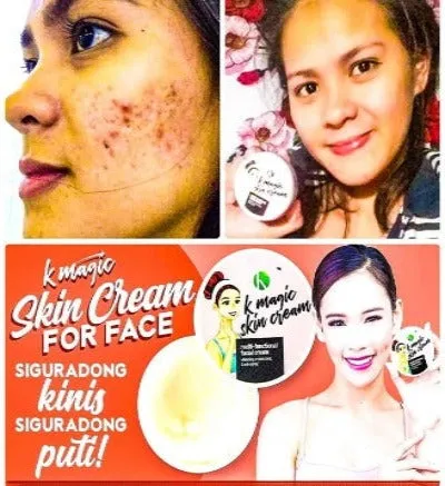 K Magic Multi-Functional Facial Skin Cream ( NOW in 2 sizes: 15 gms or 50 gms. )