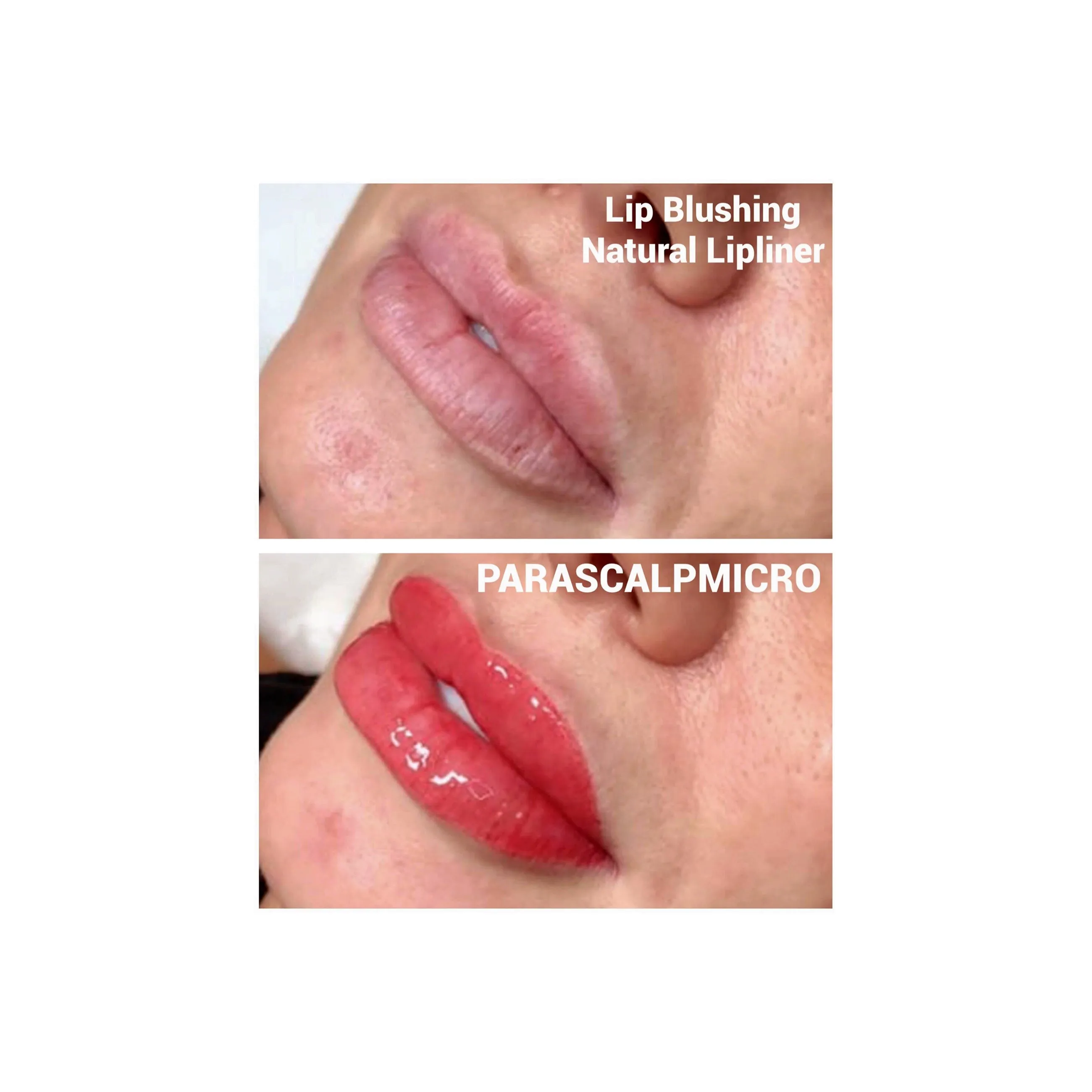 Lip Blushing & Natural Lipliner Micropigmentation