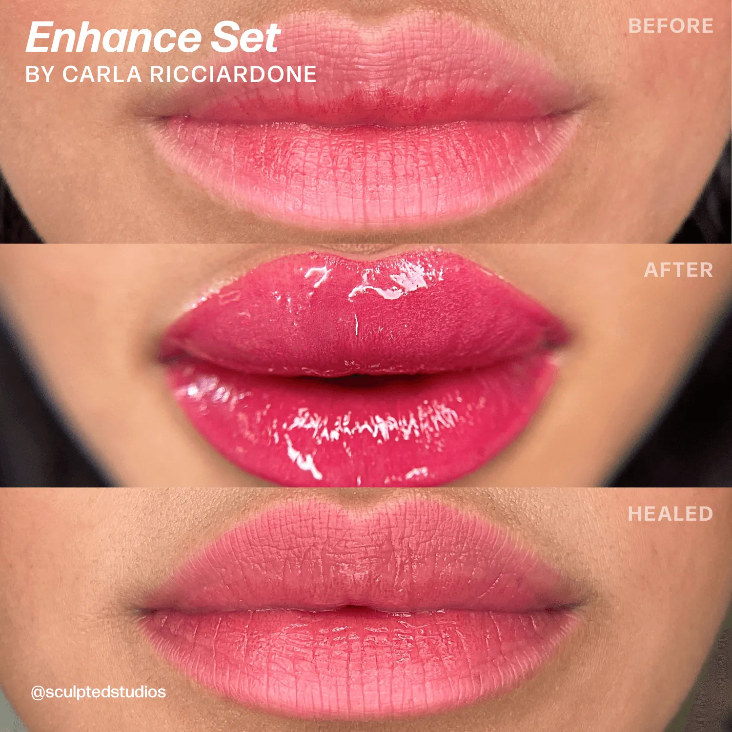 LUXE Enhance Set by Sculpted – Carla Ricciardone