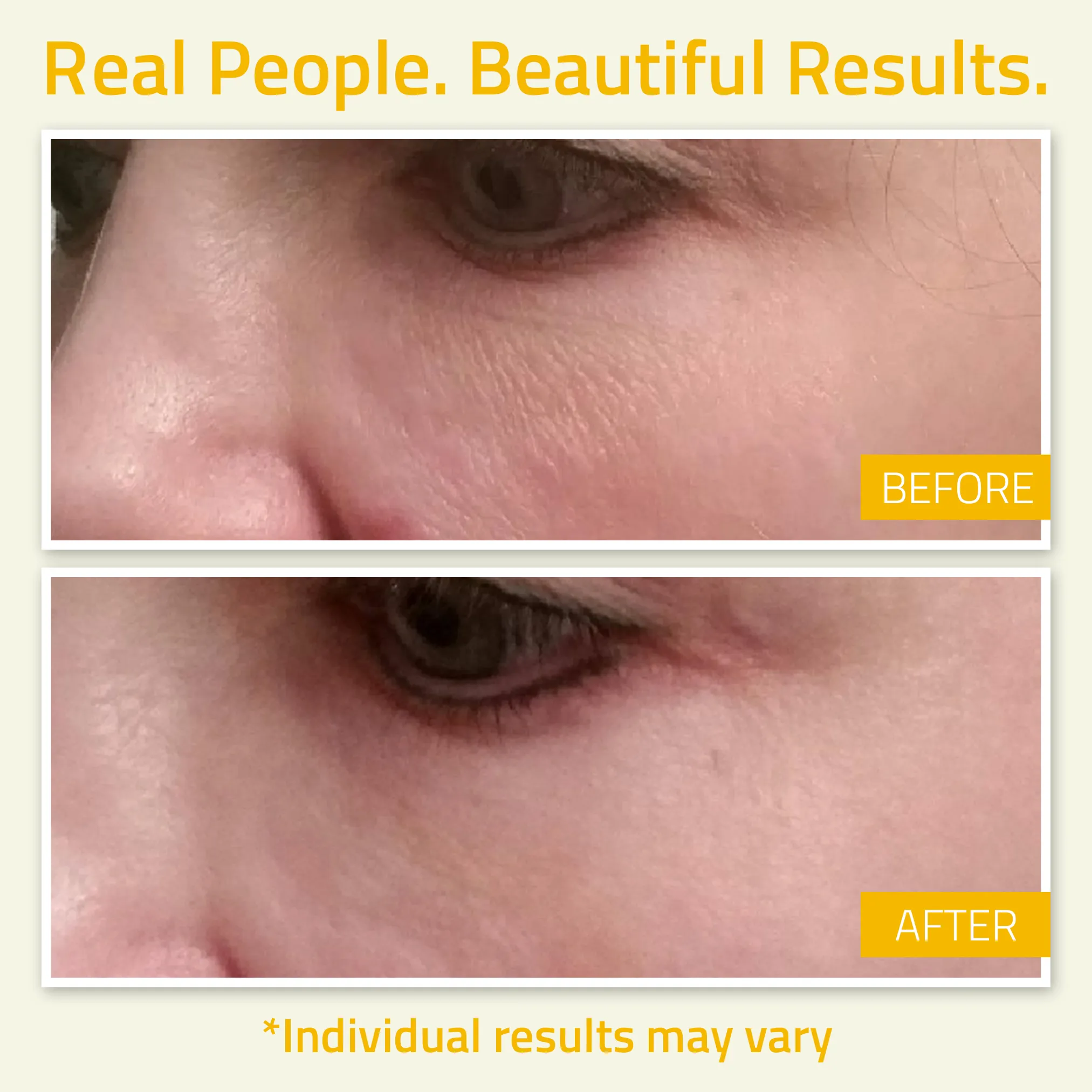 Niacinamide Serum for Face