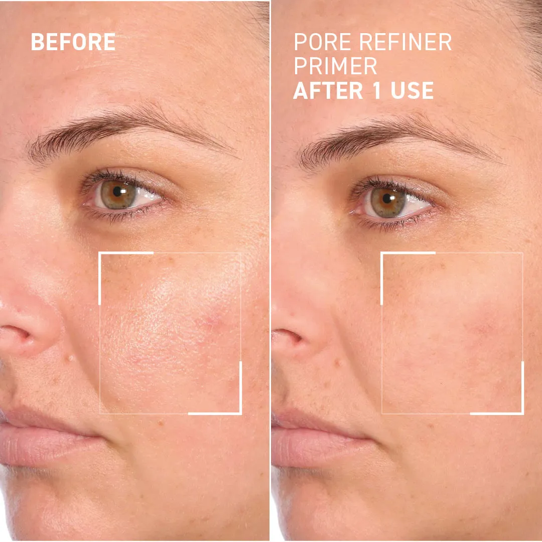 PORE REFINER PRIMER