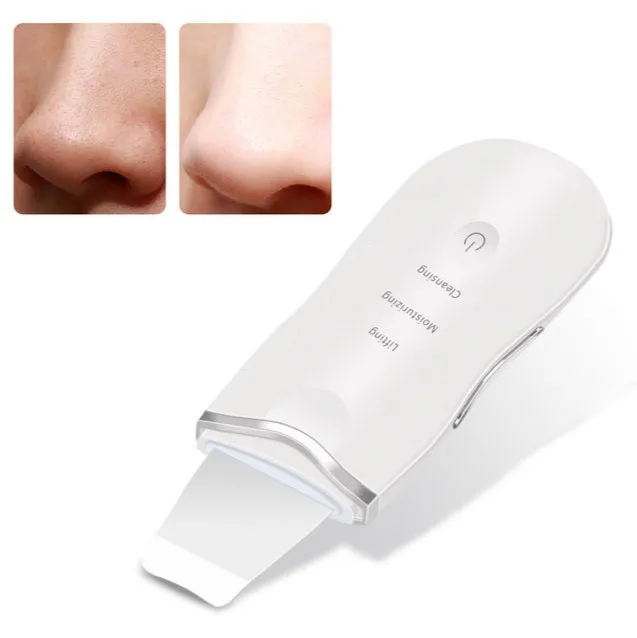 Premium Ultrasonic Skin Scrubber