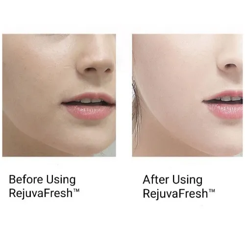 Ultrasonic Exfoliating Wand