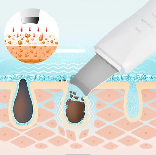 Ultrasonic Exfoliating Wand