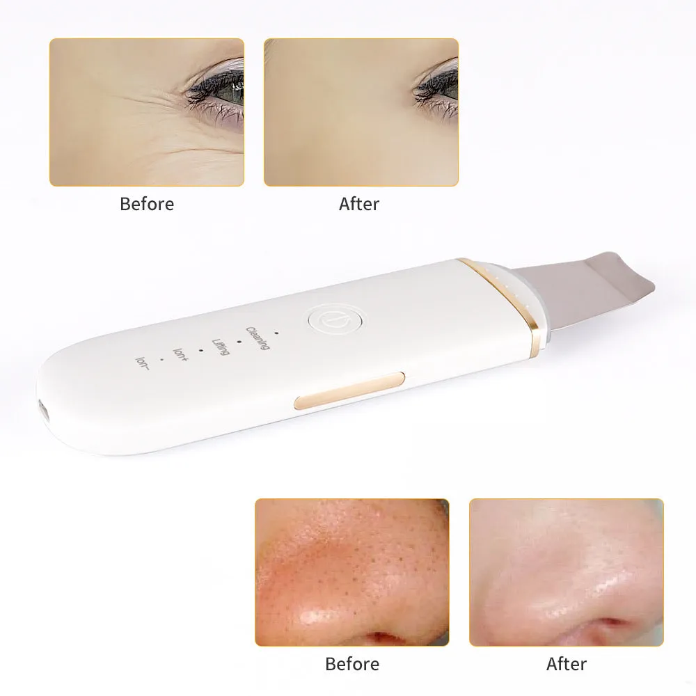 Ultrasonic Ion Skin Scrubber