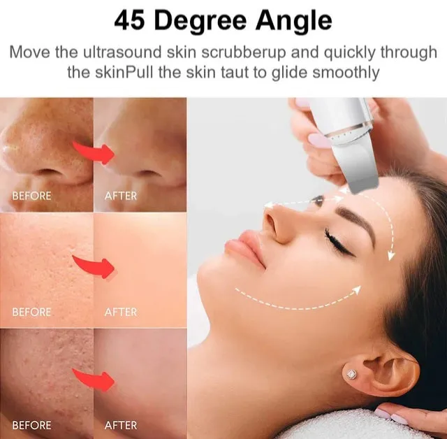 Ultrasonic Ion Skin Scrubber