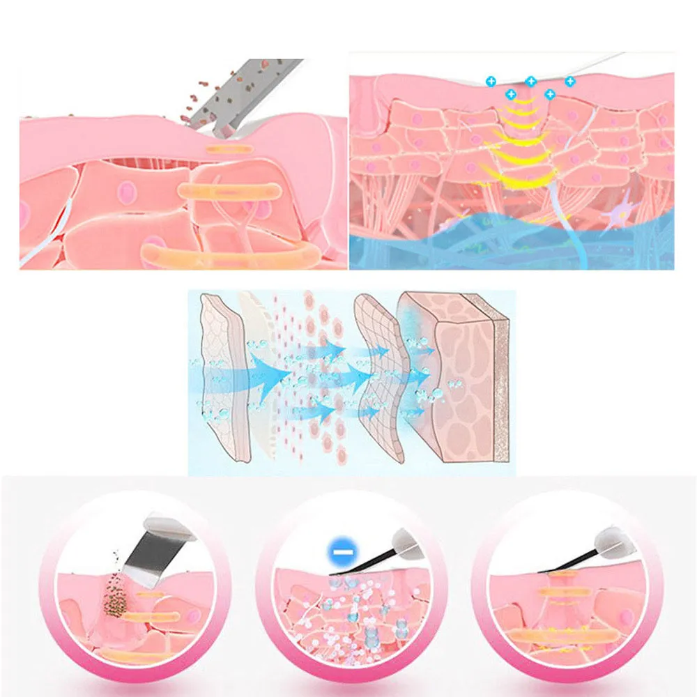 Ultrasonic Ion Skin Scrubber